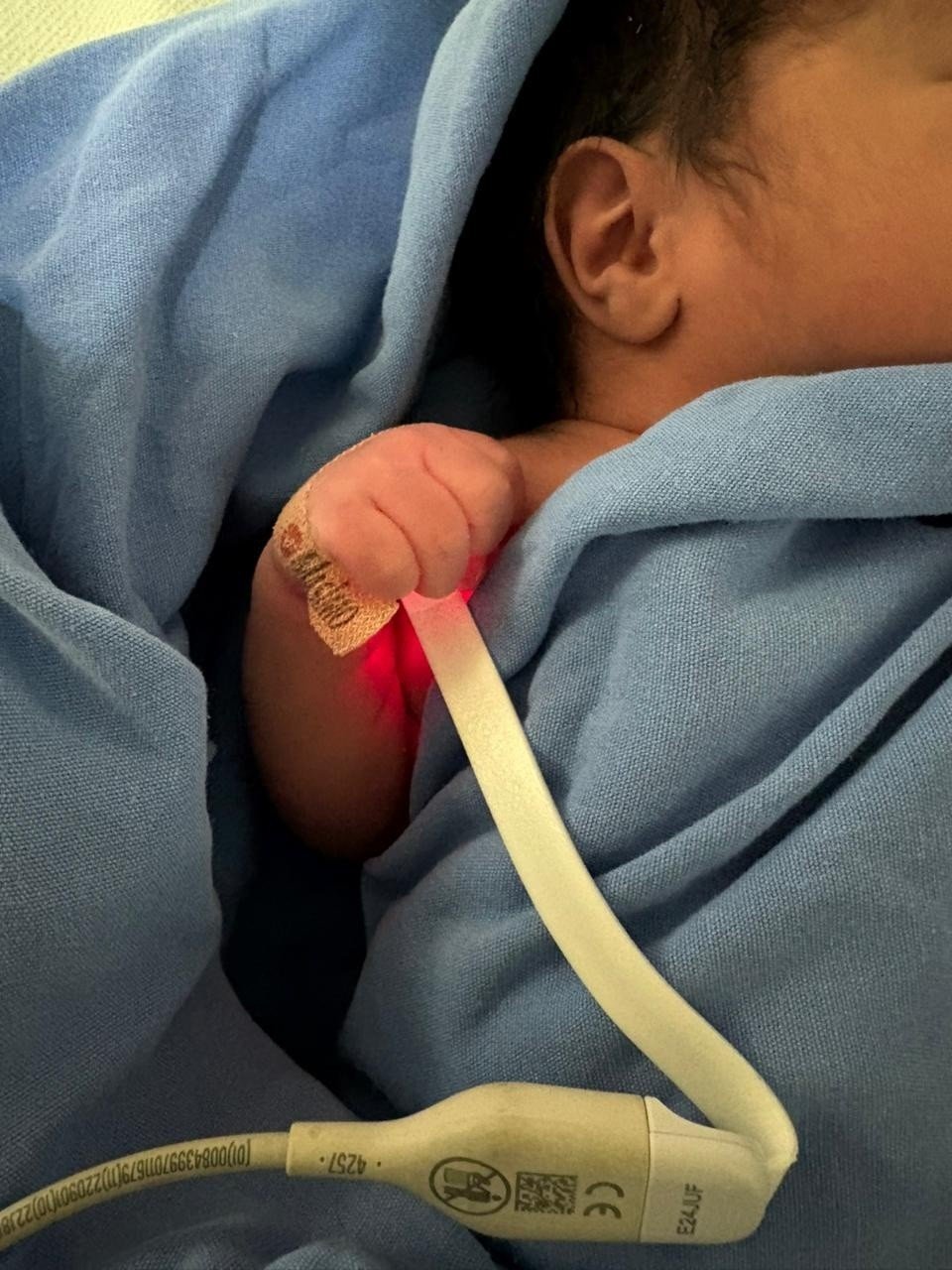 Realiza IMSS Veracruz Sur tamiz cardiaco neonatal para detectar cardiopatías en recién nacidos